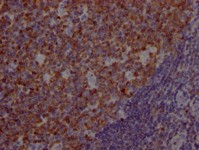 IHC image of RAC07186 diluted at 1:100 and staining in paraffin-embedded human tonsil tissue performed on a Leica BondTM system. After dewaxing and hydration, antigen retrieval was mediated by high pressure in a citrate buffer (pH 6.0). Section was blocked with 10% normal goat serum 30min at RT. Then primary antibody (1% BSA) was incubated at 4? overnight. The primary is detected by a Goat anti-rabbit IgG polymer labeled by HRP and visualized using 0.05% DAB.