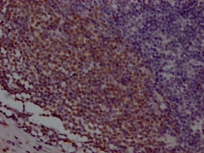 IHC image of RAC07186 diluted at 1:100 and staining in paraffin-embedded human appendix tissue performed on a Leica BondTM system. After dewaxing and hydration, antigen retrieval was mediated by high pressure in a citrate buffer (pH 6.0). Section was blocked with 10% normal goat serum 30min at RT. Then primary antibody (1% BSA) was incubated at 4? overnight. The primary is detected by a Goat anti-rabbit IgG polymer labeled by HRP and visualized using 0.05% DAB.
