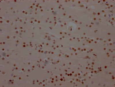 IHC image of RAC07187 diluted at 1:100 and staining in paraffin-embedded human brain tissue performed on a Leica BondTM system. After dewaxing and hydration, antigen retrieval was mediated by high pressure in a citrate buffer (pH 6.0). Section was blocked with 10% normal goat serum 30min at RT. Then primary antibody (1% BSA) was incubated at 4? overnight. The primary is detected by a Goat anti-rabbit IgG polymer labeled by HRP and visualized using 0.05% DAB.