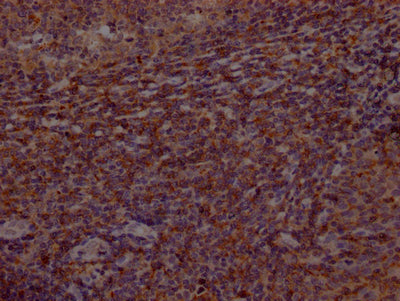 IHC image of RAC07189 diluted at 1:100 and staining in paraffin-embedded human tonsil tissue performed on a Leica BondTM system. After dewaxing and hydration, antigen retrieval was mediated by high pressure in a citrate buffer (pH 6.0). Section was blocked with 10% normal goat serum 30min at RT. Then primary antibody (1% BSA) was incubated at 4? overnight. The primary is detected by a Goat anti-rabbit IgG polymer labeled by HRP and visualized using 0.05% DAB.