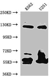 Western Blot; Positive WB detected in: K562 whole cell lysate, U-251 whole cell lysate; All lanes: BubR1 antibody at 1:1000; Secondary; Goat polyclonal to rabbit IgG at 1/50000 dilution; Predicted band size: 120, 106, 122 kDa; Observed band size: 125 kDa
