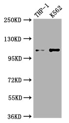 Western Blot; Positive WB detected in: THP-1 whole cell lysate, K562 whole cell lysate; All lanes: C3 antibody at 1:1000; Secondary; Goat polyclonal to rabbit IgG at 1/50000 dilution; Predicted band size: 188 kDa; Observed band size: 115 kDa