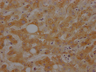 IHC image of RAC07192 diluted at 1:100 and staining in paraffin-embedded human liver tissue performed on a Leica BondTM system. After dewaxing and hydration, antigen retrieval was mediated by high pressure in a citrate buffer (pH 6.0). Section was blocked with 10% normal goat serum 30min at RT. Then primary antibody (1% BSA) was incubated at 4? overnight. The primary is detected by a Goat anti-rabbit IgG polymer labeled by HRP and visualized using 0.05% DAB.