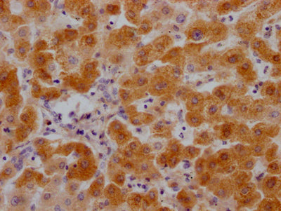 IHC image of RAC07193 diluted at 1:100 and staining in paraffin-embedded human liver tissue performed on a Leica BondTM system. After dewaxing and hydration, antigen retrieval was mediated by high pressure in a citrate buffer (pH 6.0). Section was blocked with 10% normal goat serum 30min at RT. Then primary antibody (1% BSA) was incubated at 4? overnight. The primary is detected by a Goat anti-rabbit IgG polymer labeled by HRP and visualized using 0.05% DAB.
