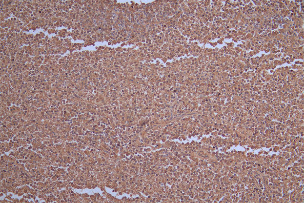 IHC image of RAC07194 diluted at 1:50 and staining in paraffin-embedded human spleen tissue performed on a Leica BondTM system. After dewaxing and hydration, antigen retrieval was mediated by high pressure in a citrate buffer (pH 6.0). Section was blocked with 10% normal goat serum 30min at RT. Then primary antibody (1% BSA) was incubated at 4Â°C overnight. The primary is detected by a Goat anti-rabbit polymer IgG labeled by HRP and visualized using 0.36% DAB.