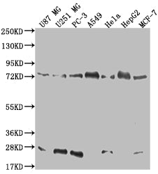 Western Blot; Positive WB detected in: U87 whole cell lysate, U251 whole cell lysate, PC3 whole cell lysate, A549 whole cell lysate, Hela whole cell lysate, HepG2 whole cell lysate, MCF-7 whole cell lysate; All lanes: CAPN2 antibody at 1:500; Secondary; Goat polyclonal to rabbit IgG at 1/50000 dilution; Predicted band size: 80, 72 kDa; Observed band size: 72-95 kDa