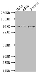 Western Blot; Positive WB detected in: Hela whole cell lysate, A549 whole cell lysate, Jurkat whole cell lysate; All lanes: CARS antibody at 1:500; Secondary; Goat polyclonal to rabbit IgG at 1/50000 dilution; Predicted band size: 86, 83, 95 kDa; Observed band size: 95 kDa