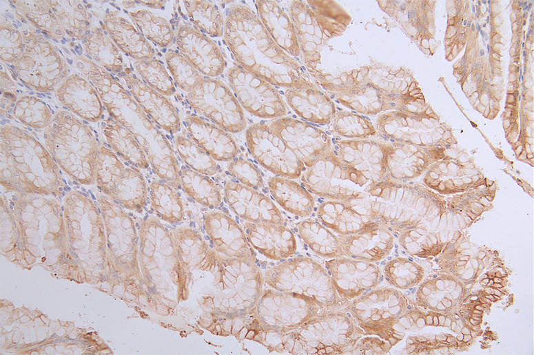 IHC image of RAC07199 diluted at 1:100 and staining in paraffin-embedded human stomach tissue performed on a Leica BondTM system. After dewaxing and hydration, antigen retrieval was mediated by high pressure in a citrate buffer (pH 6.0). Section was blocked with 10% normal goat serum 30min at RT. Then primary antibody (1% BSA) was incubated at 4Â°C overnight. The primary is detected by a Goat anti-rabbit polymer IgG labeled by HRP and visualized using 0.18% DAB.
