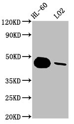 Western Blot; Positive WB detected in: HL-60 whole cell lysate, LO2 whole cell lysate; All lanes: CASP9 antibody at 1.8ug/ml; Secondary; Goat polyclonal to rabbit IgG at 1/50000 dilution; Predicted band size: 47, 31, 18, 37 KDa; Observed band size: 47 KDa