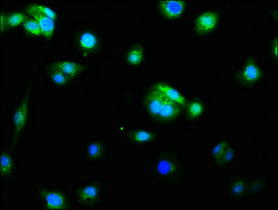 Immunofluorescence staining of HepG2 cells with RAC07200 at 1:60, counter-stained with DAPI. The cells were fixed in 4% formaldehyde, permeabilized using 0.2% Triton X-100 and blocked in 10% normal Goat Serum. The cells were then incubated with the antibody overnight at 4?. The secondary antibody was Alexa Fluor 488-congugated AffiniPure Goat Anti-Rabbit IgG (H+L).