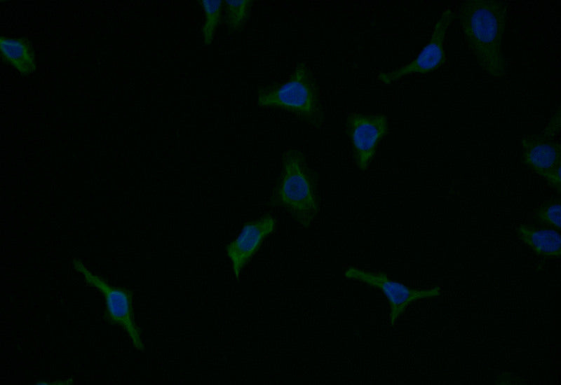Immunofluorescence staining of HepG2 with RAC07201 at 1:7, counter-stained with DAPI. The cells were fixed in 4% formaldehyde and blocked in 10% normal Goat Serum. The cells were then incubated with the antibody overnight at 4Â°C. The secondary antibody was Alexa Fluor 525-congugated AffiniPure Goat Anti-Rabbit IgG(H+L).