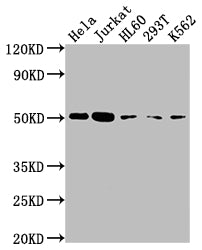 Western Blot; Positive WB detected in: Hela whole cell lysate, Jurkat whole cell lysate, HL60 whole cell lysate, 293T whole cell lysate, K562 whole cell lysate; All lanes: CASP2 antibody at 1:2000; Secondary; Goat polyclonal to rabbit IgG at 1/50000 dilution; Predicted band size: 51, 35, 11 kDa; Observed band size: 51 kDa