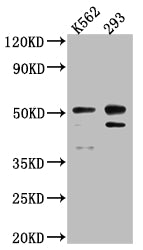 Western Blot; Positive WB detected in: K562 whole cell lysate, 293 whole cell lysate; All lanes: Caspase-2 antibody at 1:1000; Secondary; Goat polyclonal to rabbit IgG at 1/50000 dilution; Predicted band size: 51, 35, 11 kDa; Observed band size: 51 kDa