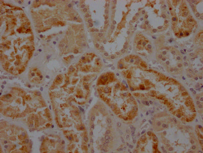 IHC image of RAC07203 diluted at 1:100 and staining in paraffin-embedded human kidney tissue performed on a Leica BondTM system. After dewaxing and hydration, antigen retrieval was mediated by high pressure in a citrate buffer (pH 6.0). Section was blocked with 10% normal goat serum 30min at RT. Then primary antibody (1% BSA) was incubated at 4? overnight. The primary is detected by a Goat anti-rabbit IgG polymer labeled by HRP and visualized using 0.05% DAB.