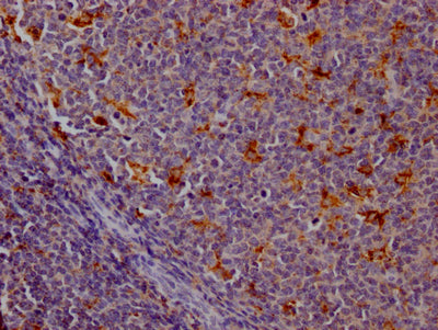 IHC image of RAC07205 diluted at 1:100 and staining in paraffin-embedded human tonsil tissue performed on a Leica BondTM system. After dewaxing and hydration, antigen retrieval was mediated by high pressure in a citrate buffer (pH 6.0). Section was blocked with 10% normal goat serum 30min at RT. Then primary antibody (1% BSA) was incubated at 4? overnight. The primary is detected by a Goat anti-rabbit IgG polymer labeled by HRP and visualized using 0.05% DAB.