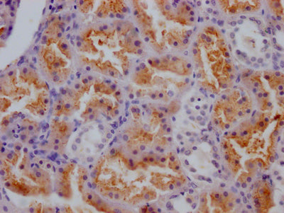 IHC image of RAC07205 diluted at 1:100 and staining in paraffin-embedded human kidney tissue performed on a Leica BondTM system. After dewaxing and hydration, antigen retrieval was mediated by high pressure in a citrate buffer (pH 6.0). Section was blocked with 10% normal goat serum 30min at RT. Then primary antibody (1% BSA) was incubated at 4? overnight. The primary is detected by a Goat anti-rabbit IgG polymer labeled by HRP and visualized using 0.05% DAB.