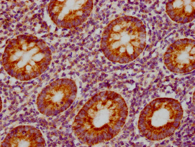 IHC image of RAC07208 diluted at 1:155 and staining in paraffin-embedded human appendix tissue performed on a Leica BondTM system. After dewaxing and hydration, antigen retrieval was mediated by high pressure in a citrate buffer (pH 6.0). Section was blocked with 10% normal goat serum 30min at RT. Then primary antibody (1% BSA) was incubated at 4? overnight. The primary is detected by a biotinylated secondary antibody and visualized using an HRP conjugated SP system.