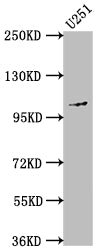 Western Blot; Positive WB detected in: U251 whole cell lysate; All lanes: MME antibody at 1:1500; Secondary; Goat polyclonal to rabbit IgG at 1/50000 dilution; Predicted band size: 86 kDa; Observed band size: 100 kDa