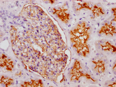 IHC image of RAC07211 diluted at 1:100 and staining in paraffin-embedded human kidney tissue performed on a Leica BondTM system. After dewaxing and hydration, antigen retrieval was mediated by high pressure in a citrate buffer (pH 6.0). Section was blocked with 10% normal goat serum 30min at RT. Then primary antibody (1% BSA) was incubated at 4? overnight. The primary is detected by a Goat anti-rabbit IgG polymer labeled by HRP and visualized using 0.05% DAB.