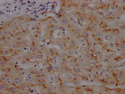 IHC image of RAC07212 diluted at 1:100 and staining in paraffin-embedded human liver tissue performed on a Leica BondTM system. After dewaxing and hydration, antigen retrieval was mediated by high pressure in a citrate buffer (pH 6.0). Section was blocked with 10% normal goat serum 30min at RT. Then primary antibody (1% BSA) was incubated at 4? overnight. The primary is detected by a Goat anti-rabbit IgG polymer labeled by HRP and visualized using 0.05% DAB.