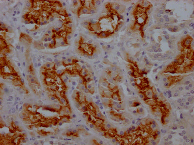 IHC image of RAC07212 diluted at 1:100 and staining in paraffin-embedded human kidney tissue performed on a Leica BondTM system. After dewaxing and hydration, antigen retrieval was mediated by high pressure in a citrate buffer (pH 6.0). Section was blocked with 10% normal goat serum 30min at RT. Then primary antibody (1% BSA) was incubated at 4? overnight. The primary is detected by a Goat anti-rabbit IgG polymer labeled by HRP and visualized using 0.05% DAB.