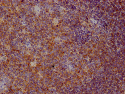 IHC image of RAC07215 diluted at 1:100 and staining in paraffin-embedded human tonsil tissue performed on a Leica BondTM system. After dewaxing and hydration, antigen retrieval was mediated by high pressure in a citrate buffer (pH 6.0). Section was blocked with 10% normal goat serum 30min at RT. Then primary antibody (1% BSA) was incubated at 4? overnight. The primary is detected by a Goat anti-rabbit IgG polymer labeled by HRP and visualized using 0.05% DAB.
