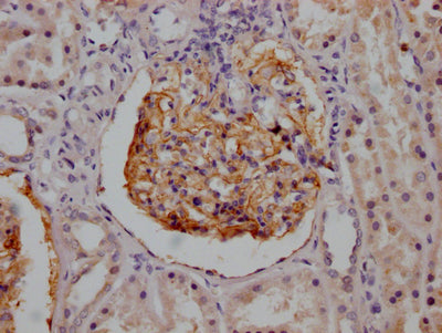 IHC image of RAC07220 diluted at 1:100 and staining in paraffin-embedded human kidney tissue performed on a Leica BondTM system. After dewaxing and hydration, antigen retrieval was mediated by high pressure in a citrate buffer (pH 6.0). Section was blocked with 10% normal goat serum 30min at RT. Then primary antibody (1% BSA) was incubated at 4? overnight. The primary is detected by a Goat anti-rabbit IgG polymer labeled by HRP and visualized using 0.05% DAB.