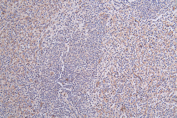 IHC image of RAC07221 diluted at 1:100 and staining in paraffin-embedded human spleen tissue performed on a Leica BondTM system. After dewaxing and hydration, antigen retrieval was mediated by high pressure in a citrate buffer (pH 6.0). Section was blocked with 10% normal goat serum 30min at RT. Then primary antibody (1% BSA) was incubated at 4Â°C overnight. The primary is detected by a Goat anti-rabbit polymer IgG labeled by HRP and visualized using 0.25% DAB.