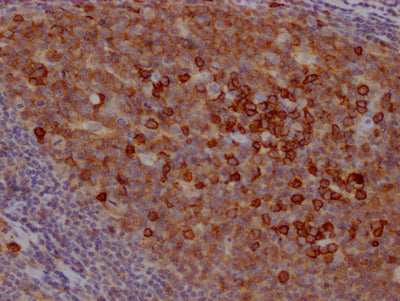IHC image of RAC07222 diluted at 1:100 and staining in paraffin-embedded human tonsil tissue performed on a Leica BondTM system. After dewaxing and hydration, antigen retrieval was mediated by high pressure in a citrate buffer (pH 6.0). Section was blocked with 10% normal goat serum 30min at RT. Then primary antibody (1% BSA) was incubated at 4? overnight. The primary is detected by a Goat anti-rabbit IgG polymer labeled by HRP and visualized using 0.05% DAB.