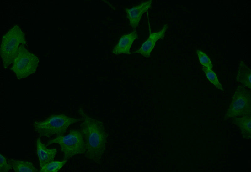 Immunofluorescence staining of Hela with RAC07223 at 1:25, counter-stained with DAPI. The cells were fixed in 4% formaldehyde and blocked in 10% normal Goat Serum. The cells were then incubated with the antibody overnight at 4Â°C. The secondary antibody was Alexa Fluor 515-congugated AffiniPure Goat Anti-Rabbit IgG(H+L).