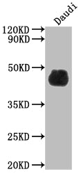 Western Blot; Positive WB detected in: Daudi whole cell lysate; All lanes: CD48 antibody at 1:2000; Secondary; Goat polyclonal to rabbit IgG at 1/50000 dilution; Predicted band size: 28, 20 kDa; Observed band size: 45 kDa