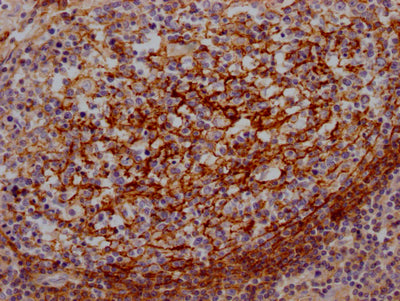 IHC image of RAC07226 diluted at 1:100 and staining in paraffin-embedded human lung tissue performed on a Leica BondTM system. After dewaxing and hydration, antigen retrieval was mediated by high pressure in a citrate buffer (pH 6.0). Section was blocked with 10% normal goat serum 30min at RT. Then primary antibody (1% BSA) was incubated at 4? overnight. The primary is detected by a Goat anti-rabbit IgG polymer labeled by HRP and visualized using 0.05% DAB.
