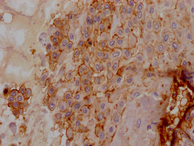 IHC image of RAC07226 diluted at 1:100 and staining in paraffin-embedded human placenta tissue performed on a Leica BondTM system. After dewaxing and hydration, antigen retrieval was mediated by high pressure in a citrate buffer (pH 6.0). Section was blocked with 10% normal goat serum 30min at RT. Then primary antibody (1% BSA) was incubated at 4? overnight. The primary is detected by a Goat anti-rabbit IgG polymer labeled by HRP and visualized using 0.05% DAB.