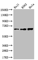 Western Blot; Positive WB detected in: Raji whole cell lysate, K562 whole cell lysate, Hela whole cell lysate; All lanes: CD58 antibody at 1:2000; Secondary; Goat polyclonal to rabbit IgG at 1/50000 dilution; Predicted band size: 29, 27, 26 kDa; Observed band size: 55-70 kDa