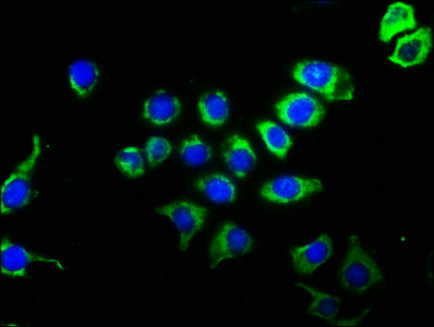 Immunofluorescence staining of A549 cells with RAC07229 at 1:51, counter-stained with DAPI. The cells were fixed in 4% formaldehyde, permeabilized using 0.2% Triton X-100 and blocked in 10% normal Goat Serum. The cells were then incubated with the antibody overnight at 4?. The secondary antibody was Alexa Fluor 488-congugated AffiniPure Goat Anti-Rabbit IgG (H+L).