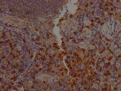IHC image of RAC07231 diluted at 1:100 and staining in paraffin-embedded human tonsil tissue performed on a Leica BondTM system. After dewaxing and hydration, antigen retrieval was mediated by high pressure in a citrate buffer (pH 6.0). Section was blocked with 10% normal goat serum 30min at RT. Then primary antibody (1% BSA) was incubated at 4? overnight. The primary is detected by a Goat anti-rabbit IgG polymer labeled by HRP and visualized using 0.05% DAB.