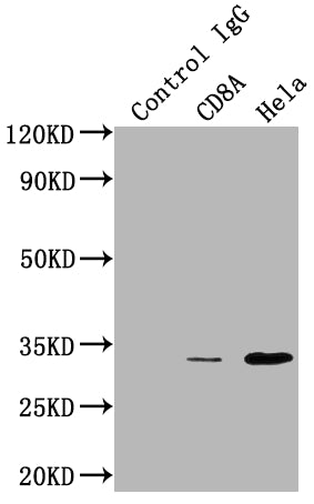 Immunoprecipitating CD8A in HepG2 whole cell lysate; Lane 1: Rabbit control IgG instead of RAC07231 in HepG2 whole cell lysate.For western blotting,a HRP-conjugated Protein G antibody was used as the secondary antibody (1/2000); Lane 2:RAC07231(3ug)+ HepG2 whole cell lysate(500ug); Lane 3: HepG2 whole cell lysate (10ug)