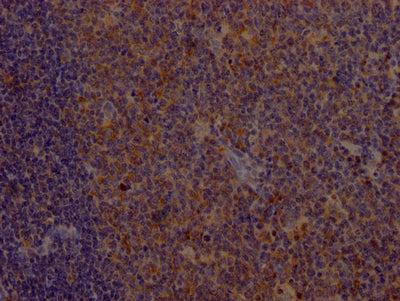 IHC image of RAC07232 diluted at 1:100 and staining in paraffin-embedded human tonsil tissue performed on a Leica BondTM system. After dewaxing and hydration, antigen retrieval was mediated by high pressure in a citrate buffer (pH 6.0). Section was blocked with 10% normal goat serum 30min at RT. Then primary antibody (1% BSA) was incubated at 4? overnight. The primary is detected by a Goat anti-rabbit IgG polymer labeled by HRP and visualized using 0.05% DAB.