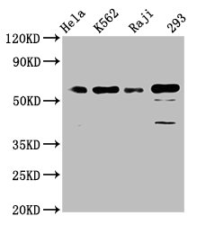 Western Blot; Positive WB detected in: Hela whole cell lysate, K562 whole cell lysate, Raji whole cell lysate, 293 whole cell lysate; All lanes: Cdc25C antibody at 1.65ug/ml; Secondary; Goat polyclonal to rabbit IgG at 1/50000 dilution; Predicted band size: 54, 52, 49, 46 KDa; Observed band size: 60 KDa