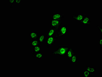 Immunofluorescence staining of Hela cells with RAC07234 at 1:55, counter-stained with DAPI. The cells were fixed in 4% formaldehyde, permeabilized using 0.2% Triton X-100 and blocked in 10% normal Goat Serum. The cells were then incubated with the antibody overnight at 4?. The secondary antibody was Alexa Fluor 488-congugated AffiniPure Goat Anti-Rabbit IgG (H+L).