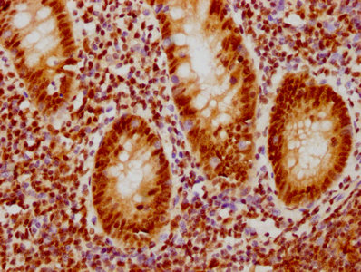 IHC image of RAC07237 diluted at 1:126.5 and staining in paraffin-embedded human appendix tissue performed on a Leica BondTM system. After dewaxing and hydration, antigen retrieval was mediated by high pressure in a citrate buffer (pH 6.0). Section was blocked with 10% normal goat serum 30min at RT. Then primary antibody (1% BSA) was incubated at 4? overnight. The primary is detected by a biotinylated secondary antibody and visualized using an HRP conjugated SP system.