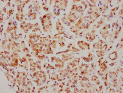 IHC image of RAC07237 diluted at 1:126.5 and staining in paraffin-embedded human pancreatic tissue performed on a Leica BondTM system. After dewaxing and hydration, antigen retrieval was mediated by high pressure in a citrate buffer (pH 6.0). Section was blocked with 10% normal goat serum 30min at RT. Then primary antibody (1% BSA) was incubated at 4? overnight. The primary is detected by a biotinylated secondary antibody and visualized using an HRP conjugated SP system.