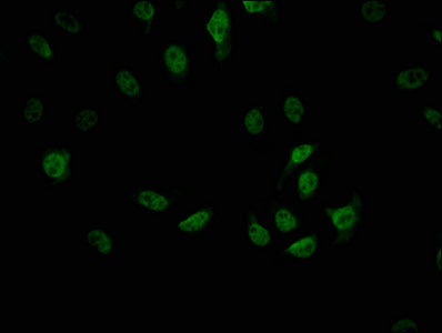 Immunofluorescence staining of A549 cells with RAC07237 at 1:42, counter-stained with DAPI. The cells were fixed in 4% formaldehyde, permeabilized using 0.2% Triton X-100 and blocked in 10% normal Goat Serum. The cells were then incubated with the antibody overnight at 4?. The secondary antibody was Alexa Fluor 488-congugated AffiniPure Goat Anti-Rabbit IgG (H+L).