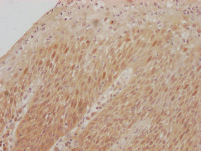 IHC image of RAC07238 diluted at 1:100 and staining in paraffin-embedded human tonsil tissue performed on a Leica BondTM system. After dewaxing and hydration, antigen retrieval was mediated by high pressure in a citrate buffer (pH 6.0). Section was blocked with 10% normal goat serum 30min at RT. Then primary antibody (1% BSA) was incubated at 4? overnight. The primary is detected by a Goat anti-rabbit IgG polymer labeled by HRP and visualized using 0.05% DAB.