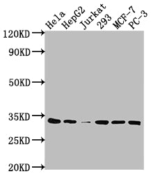 Western Blot; Positive WB detected in: Hela whole cell lysate, HepG2 whole cell lysate, Jurkat whole cell lysate, 293 whole cell lysate, MCF-7 whole cell lysate, PC-3 whole cell lysate; All lanes: CDK4 antibody at 1:2000; Secondary; Goat polyclonal to rabbit IgG at 1/50000 dilution; Predicted band size: 34, 21 kDa; Observed band size: 34 kDa