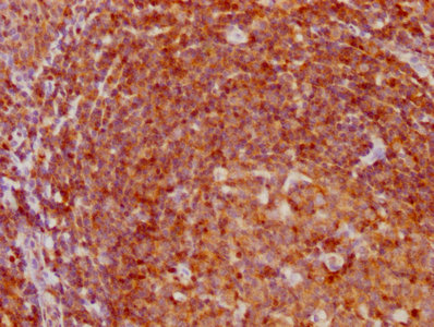 IHC image of RAC07241 diluted at 1:97.5 and staining in paraffin-embedded human tonsil tissue performed on a Leica BondTM system. After dewaxing and hydration, antigen retrieval was mediated by high pressure in a citrate buffer (pH 6.0). Section was blocked with 10% normal goat serum 30min at RT. Then primary antibody (1% BSA) was incubated at 4? overnight. The primary is detected by a biotinylated secondary antibody and visualized using an HRP conjugated SP system.