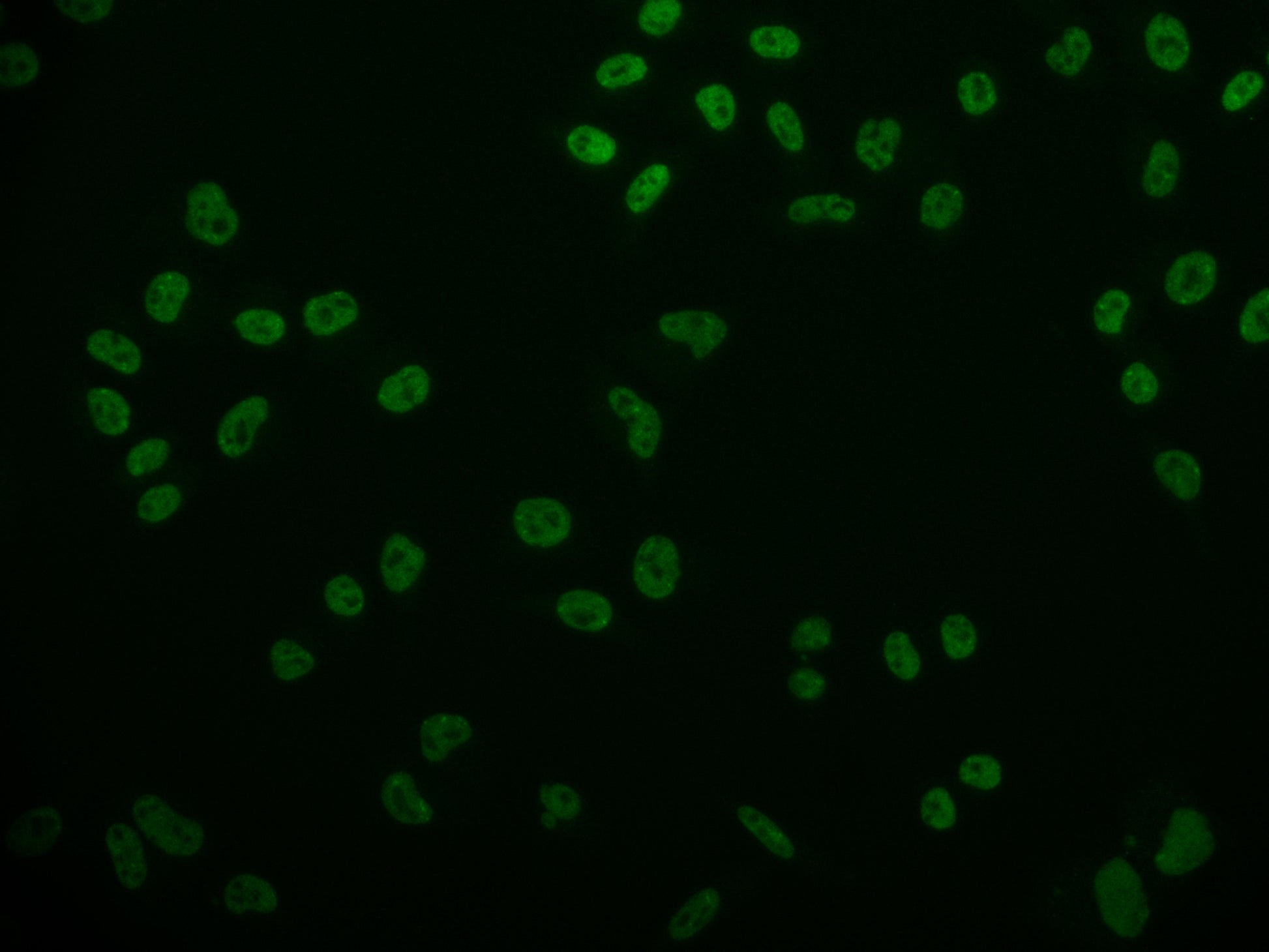 Immunofluorescence staining of Hela cell with RAC07242 at 1:50, counter-stained with DAPI. The cells were fixed in 4% formaldehyde and blocked in 10% normal Goat Serum. The cells were then incubated with the antibody overnight at 4Â°C. The secondary antibody was Alexa Fluor 524-congugated AffiniPure Goat Anti-Rabbit IgG(H+L).