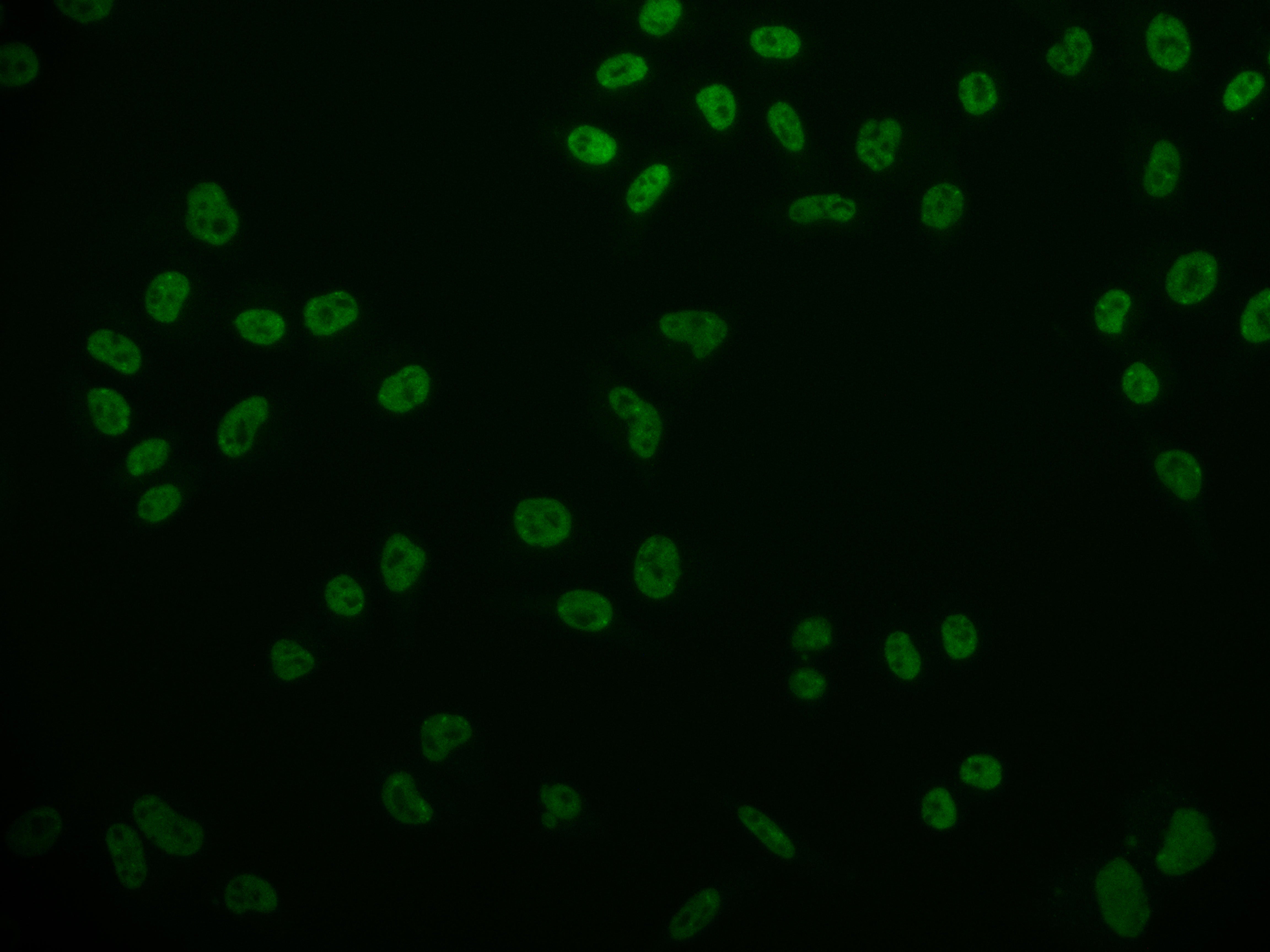 Immunofluorescence staining of Hela cell with RAC07242 at 1:50, counter-stained with DAPI. The cells were fixed in 4% formaldehyde and blocked in 10% normal Goat Serum. The cells were then incubated with the antibody overnight at 4Â°C. The secondary antibody was Alexa Fluor 524-congugated AffiniPure Goat Anti-Rabbit IgG(H+L).