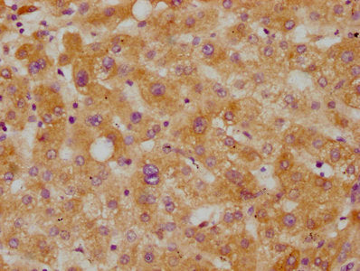 IHC image of RAC07245 diluted at 1:115 and staining in paraffin-embedded human liver tissue performed on a Leica BondTM system. After dewaxing and hydration, antigen retrieval was mediated by high pressure in a citrate buffer (pH 6.0). Section was blocked with 10% normal goat serum 30min at RT. Then primary antibody (1% BSA) was incubated at 4? overnight. The primary is detected by a biotinylated secondary antibody and visualized using an HRP conjugated SP system.