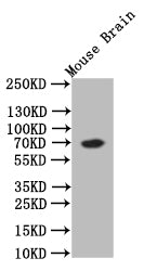 Western Blot; Positive WB detected in: Mouse Brain tissue lysate; All lanes: CHAT antibody at 1:500; Secondary; Goat polyclonal to rabbit IgG at 1/50000 dilution; Predicted band size: 70 kDa; Observed band size: 70 kDa
